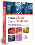 Liver Transplantation