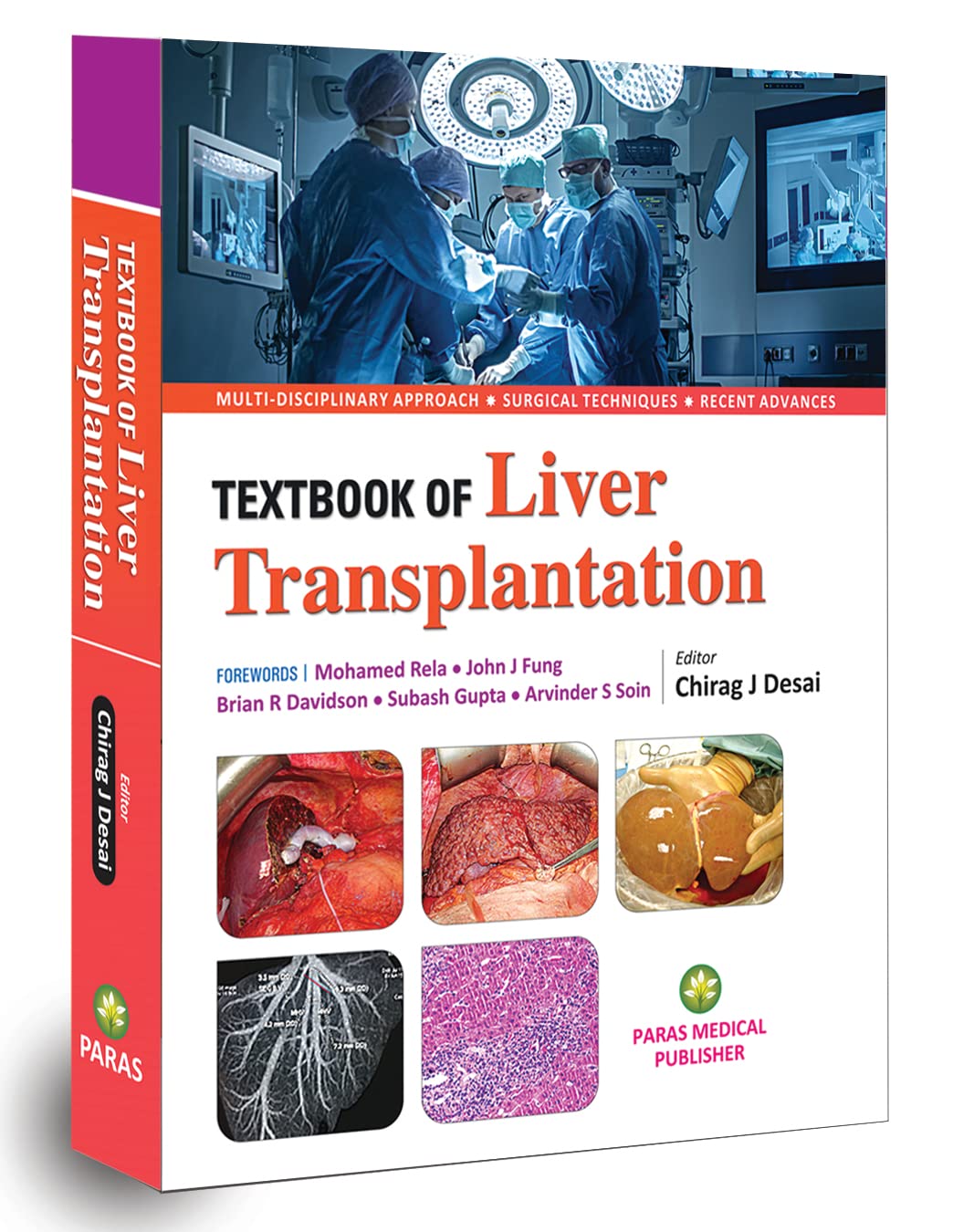 Liver Transplantation