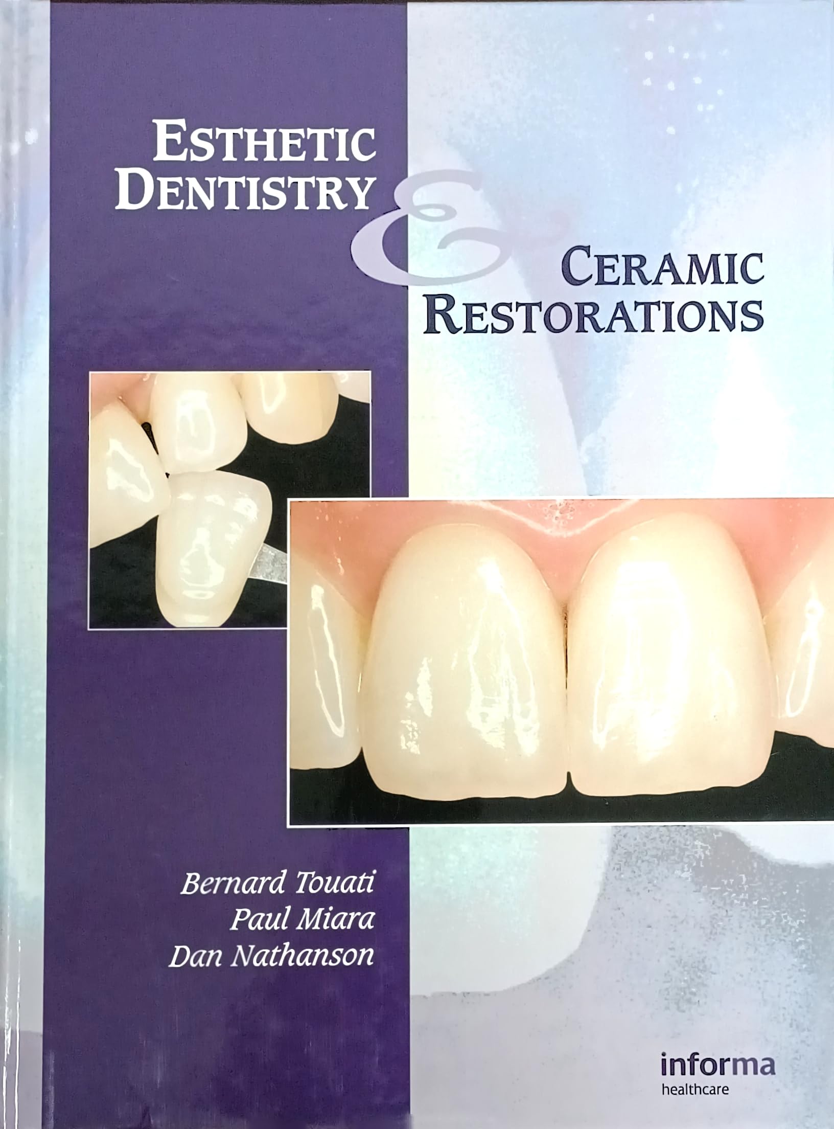 Esthetic Dentistry and Ceramic Restoration
