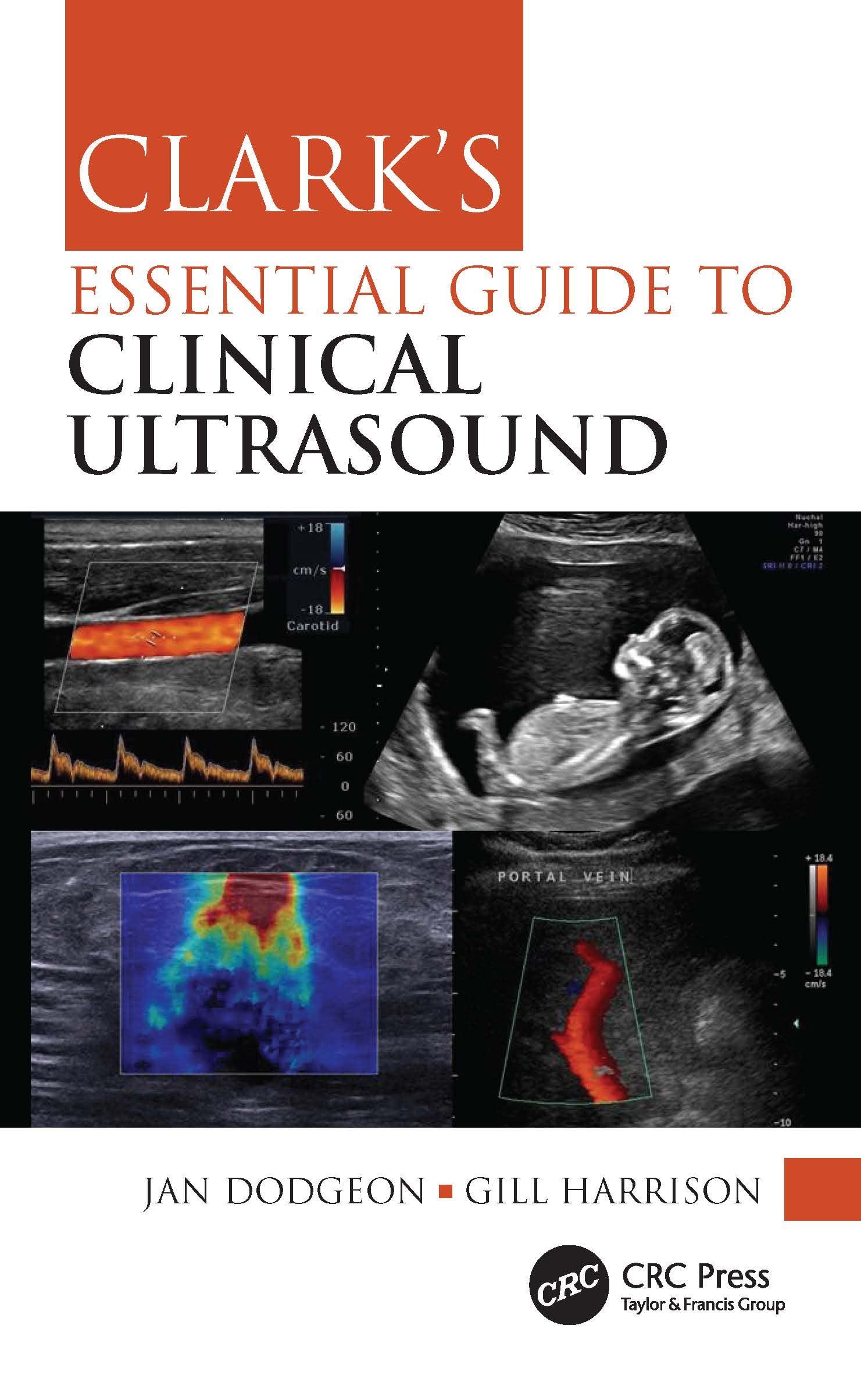 ClarkS Essential Guide To Clinical Ultrasound (Clarks Companion Essential Guides)