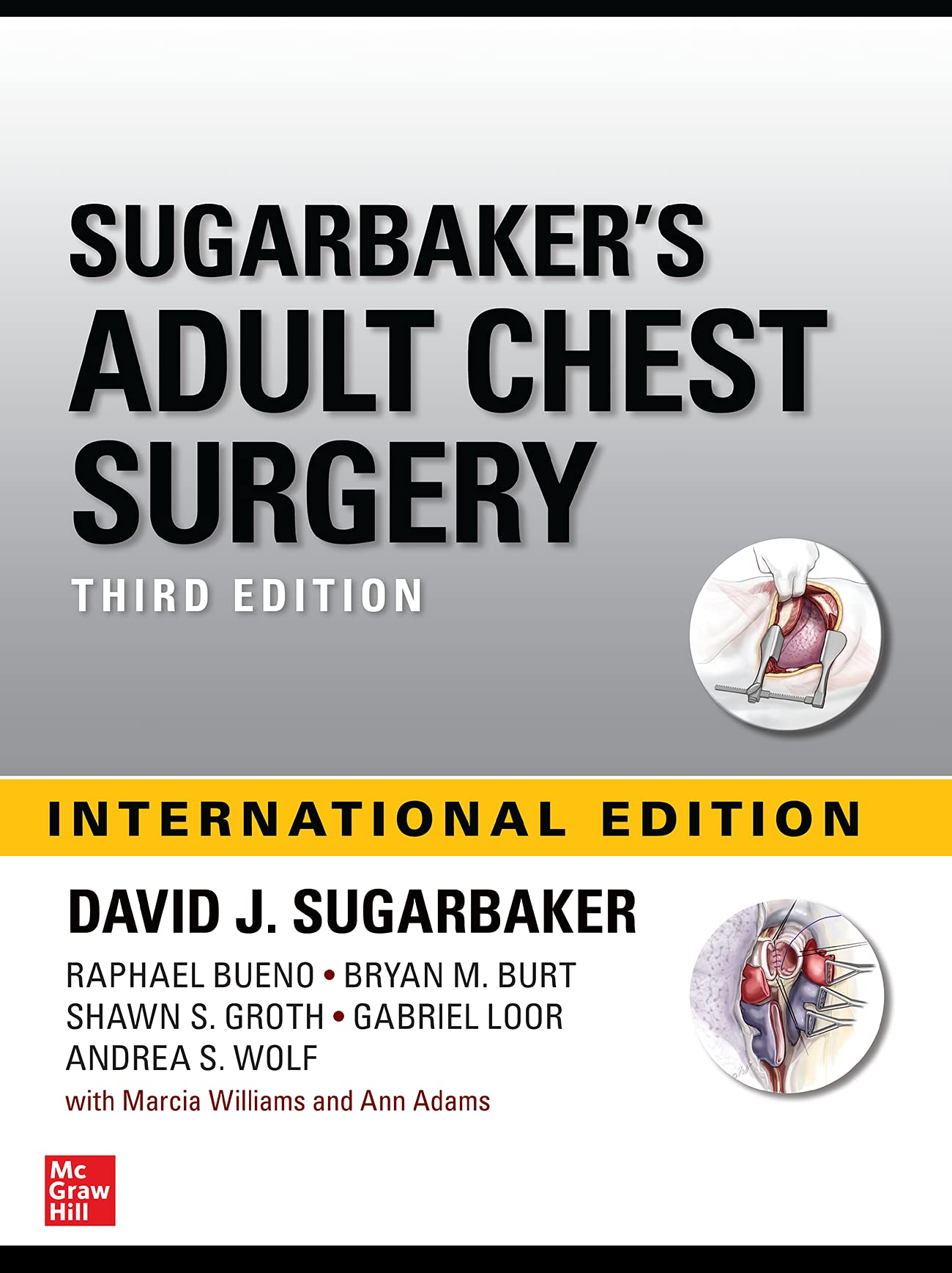 Adult Chest Surgery, 3 Edition