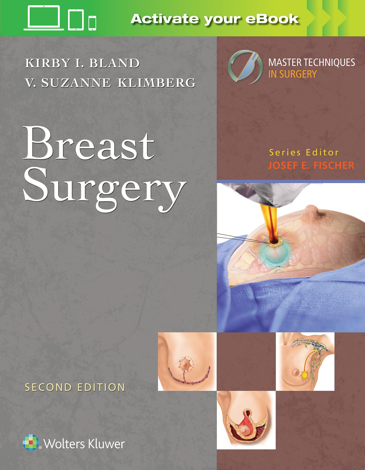 Breast Surgery 2Ed (Hb 2019) (Master Techiques In Surgery)