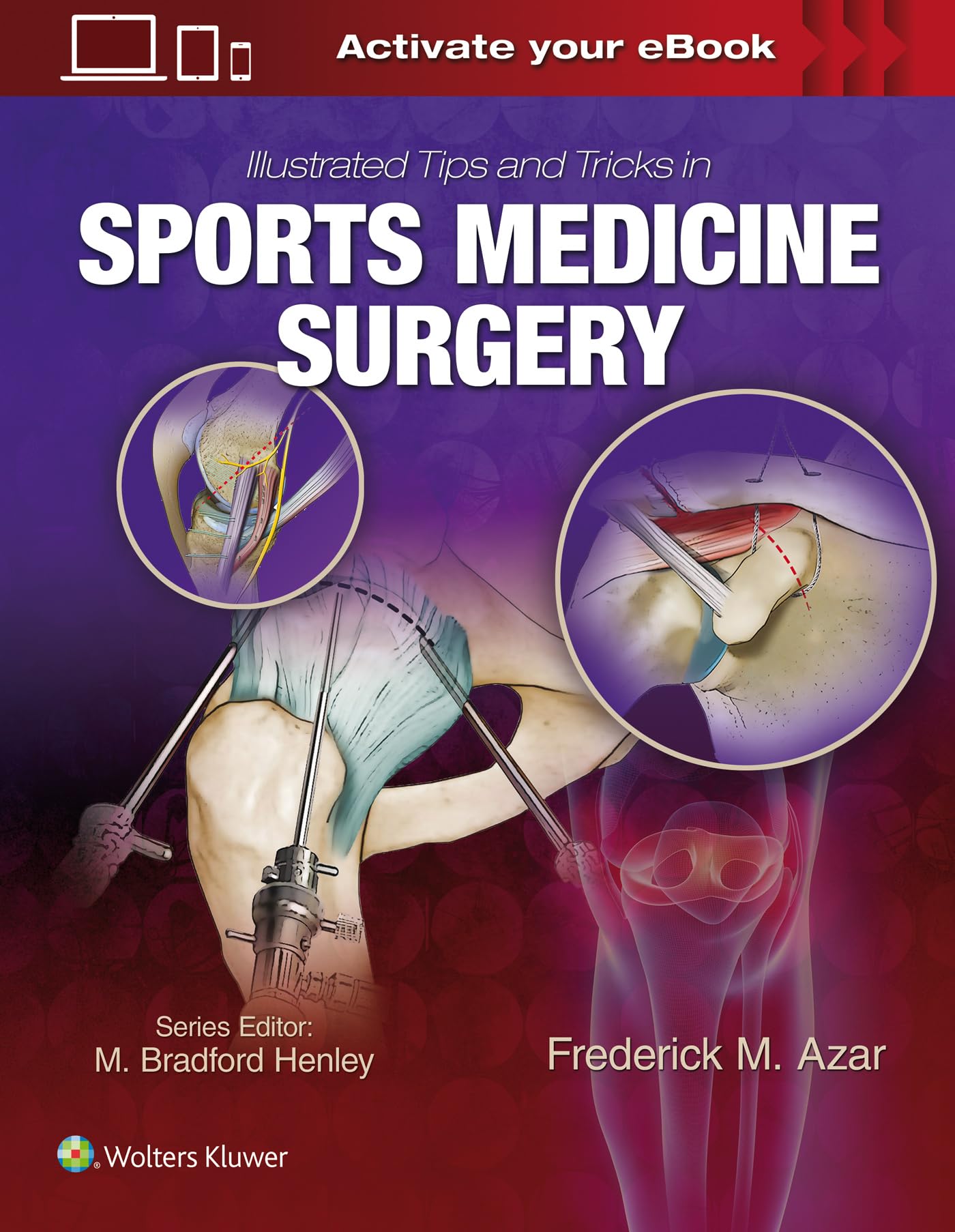 Illustrated Tips And Tricks In Sports Medicine Surgery