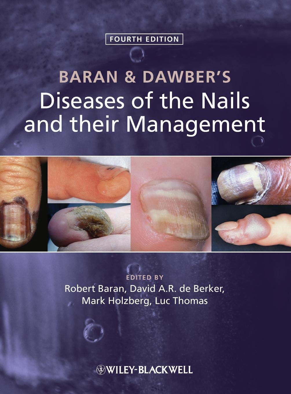 Baran and Dawbers Diseases of the Nails and their Management