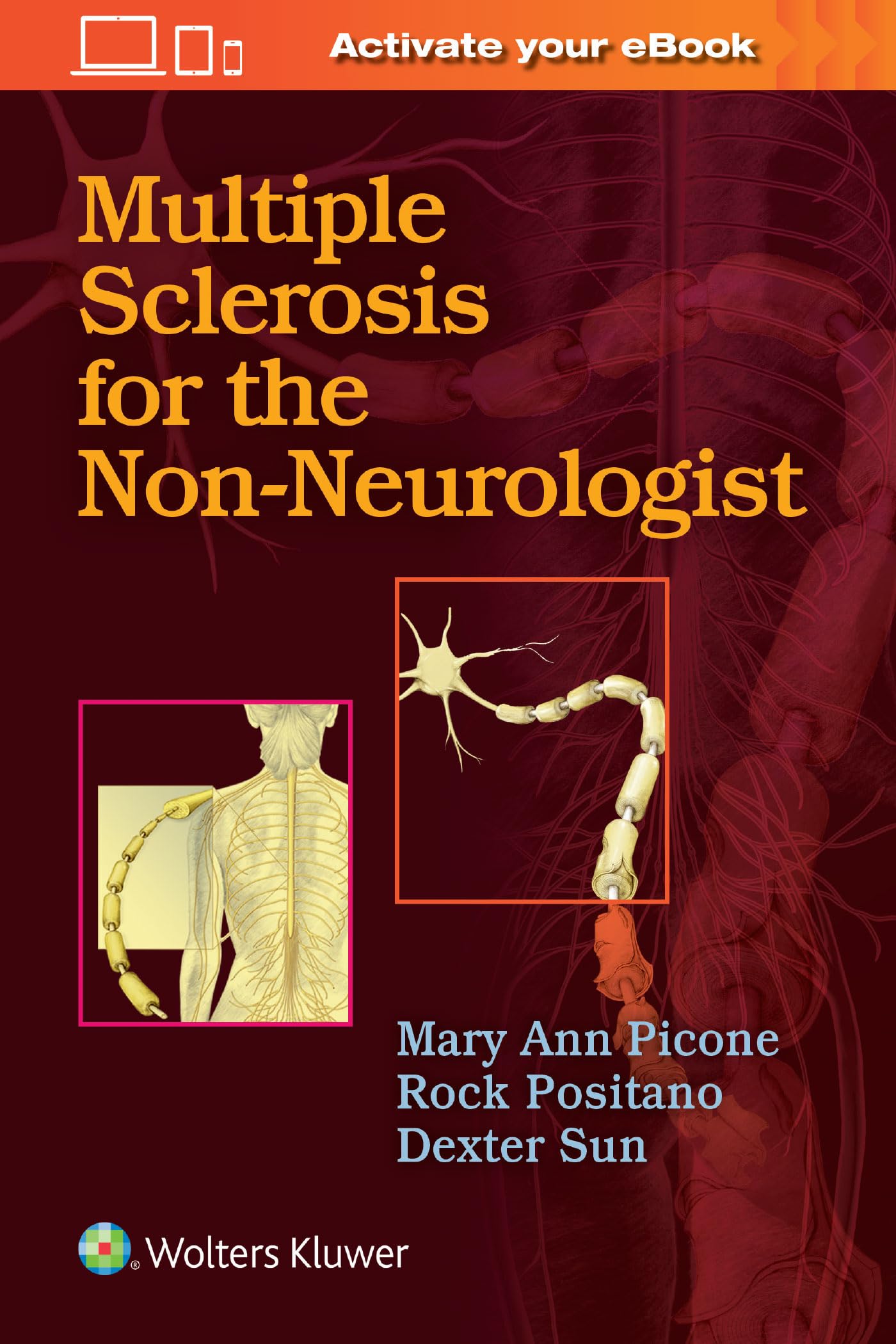 Multiple Sclerosis for the NonNeurologist