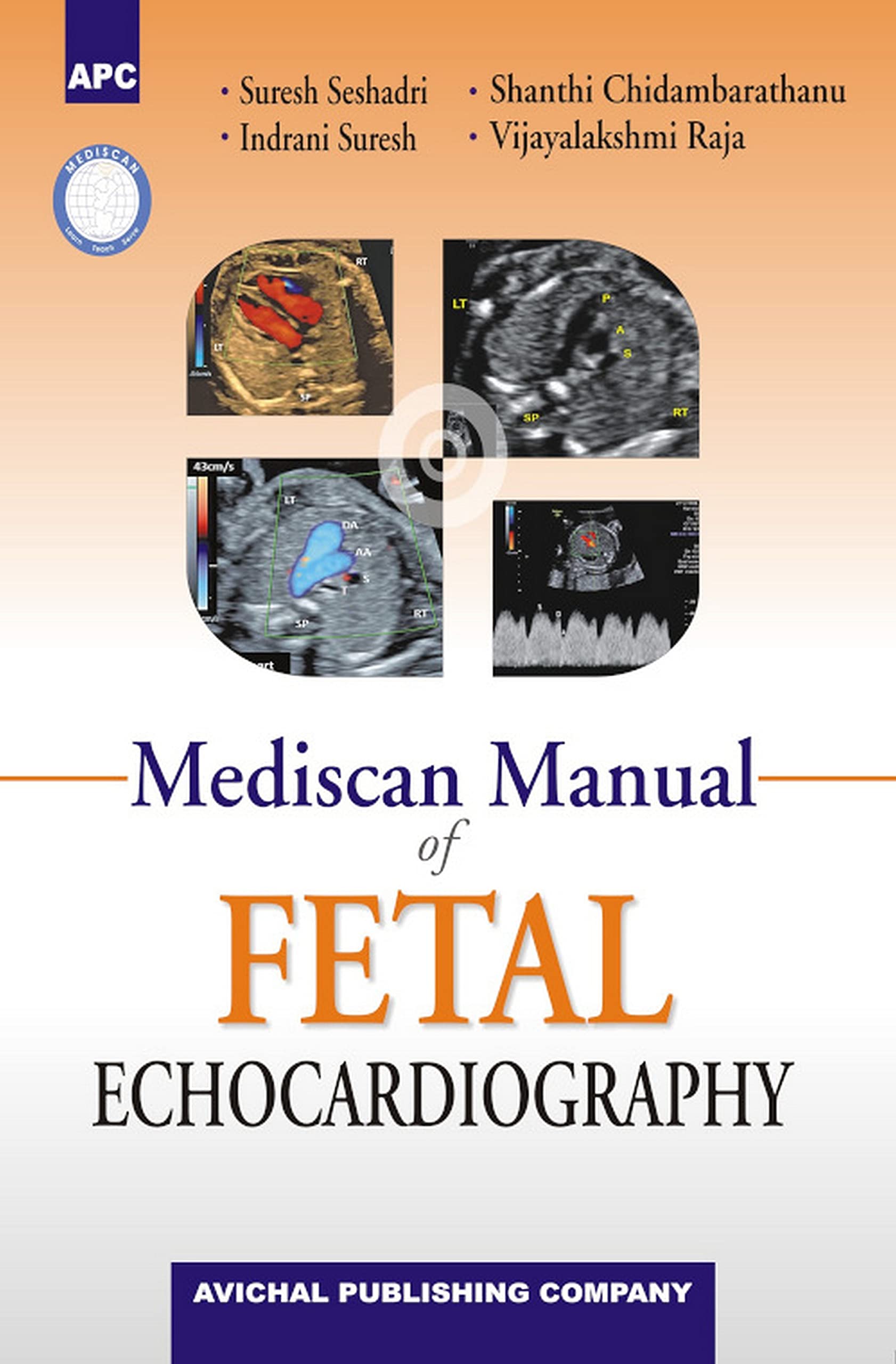 Mediscan Manual Of Fetal Ecocardiography