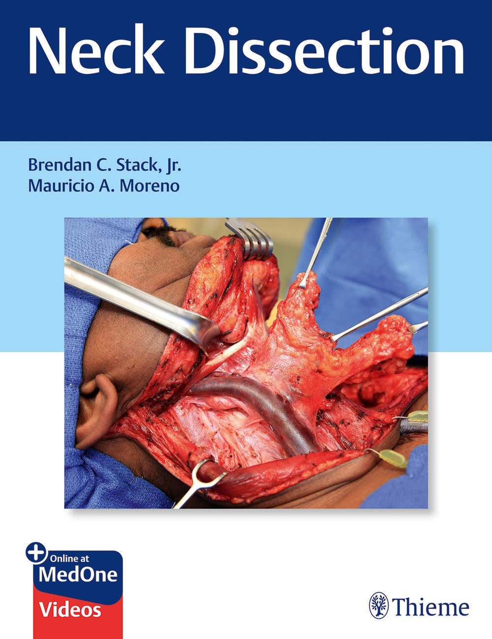 NECK DISSECTION (HB 2019)