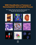 WHO Classification of Tumours of Haematopoietic and Lymphoid Tissues [OP]