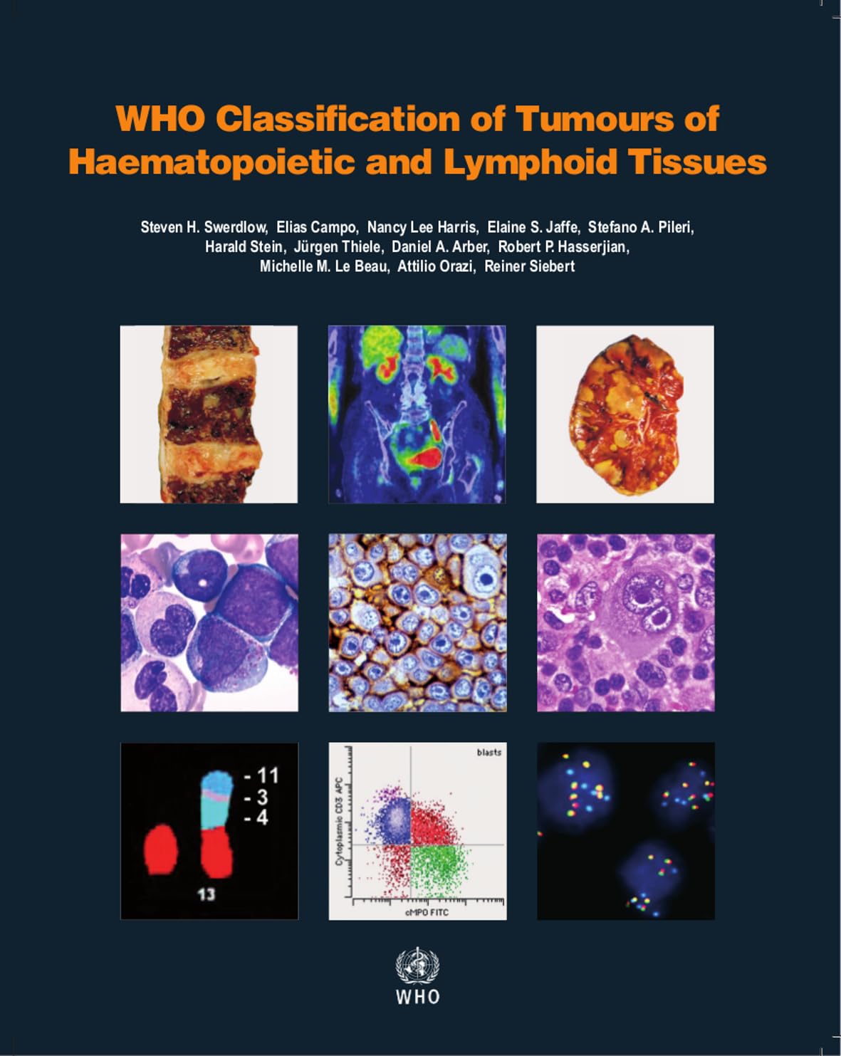 WHO Classification of Tumours of Haematopoietic and Lymphoid Tissues [OP]