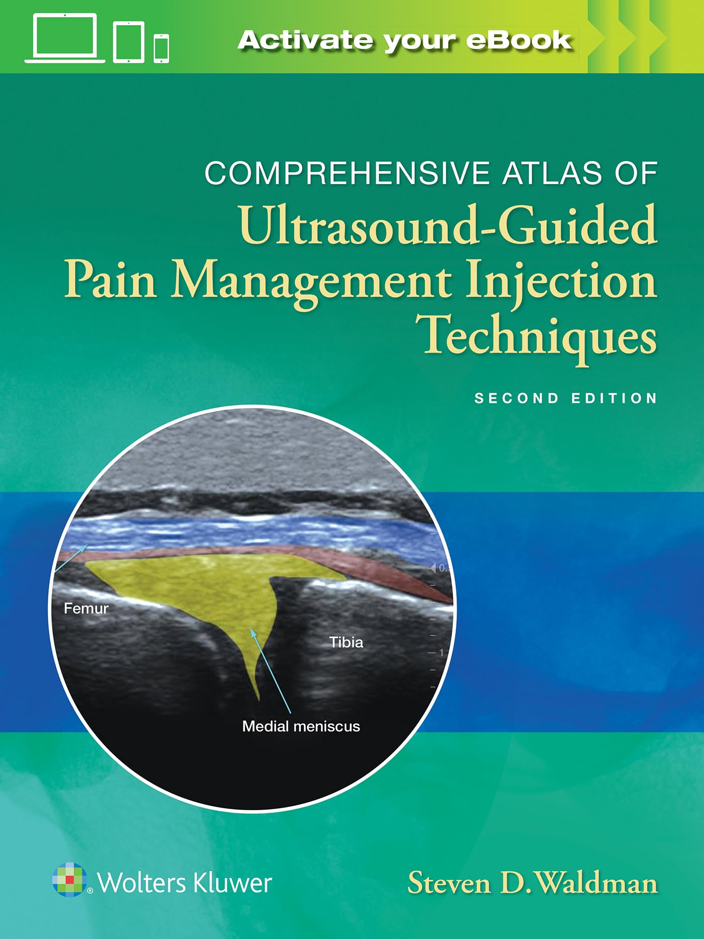 Comprehensive Atlas of UltrasoundGuided Pain Management Injection Techniques