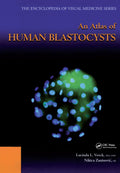 An Atlas of Human Blastocysts (Encyclopedia of Visual Medicine Series, 59)