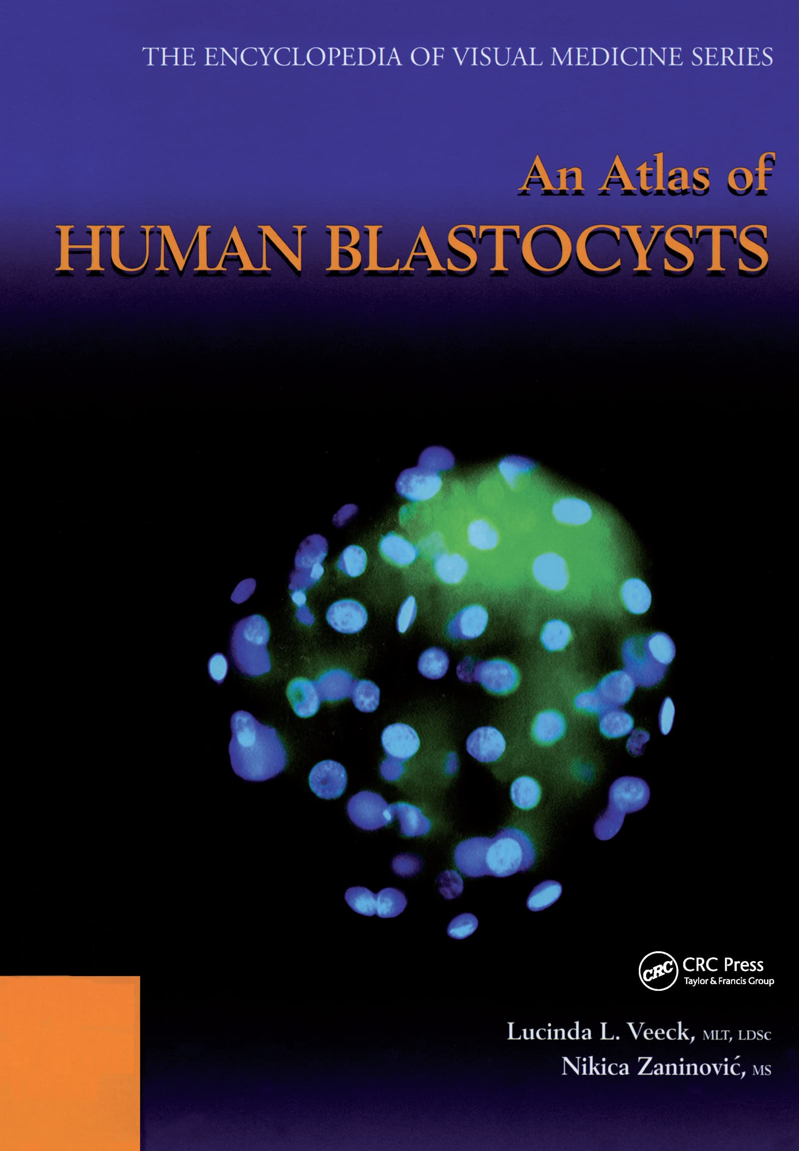 An Atlas of Human Blastocysts (Encyclopedia of Visual Medicine Series, 59)