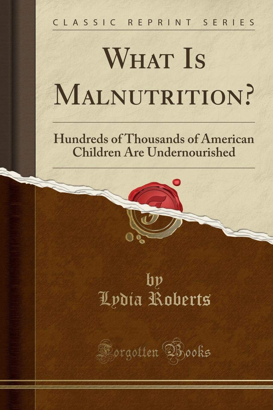 What Is Malnutrition?: Hundreds of Thousands of American Children Are Undernourished (Classic Reprint)