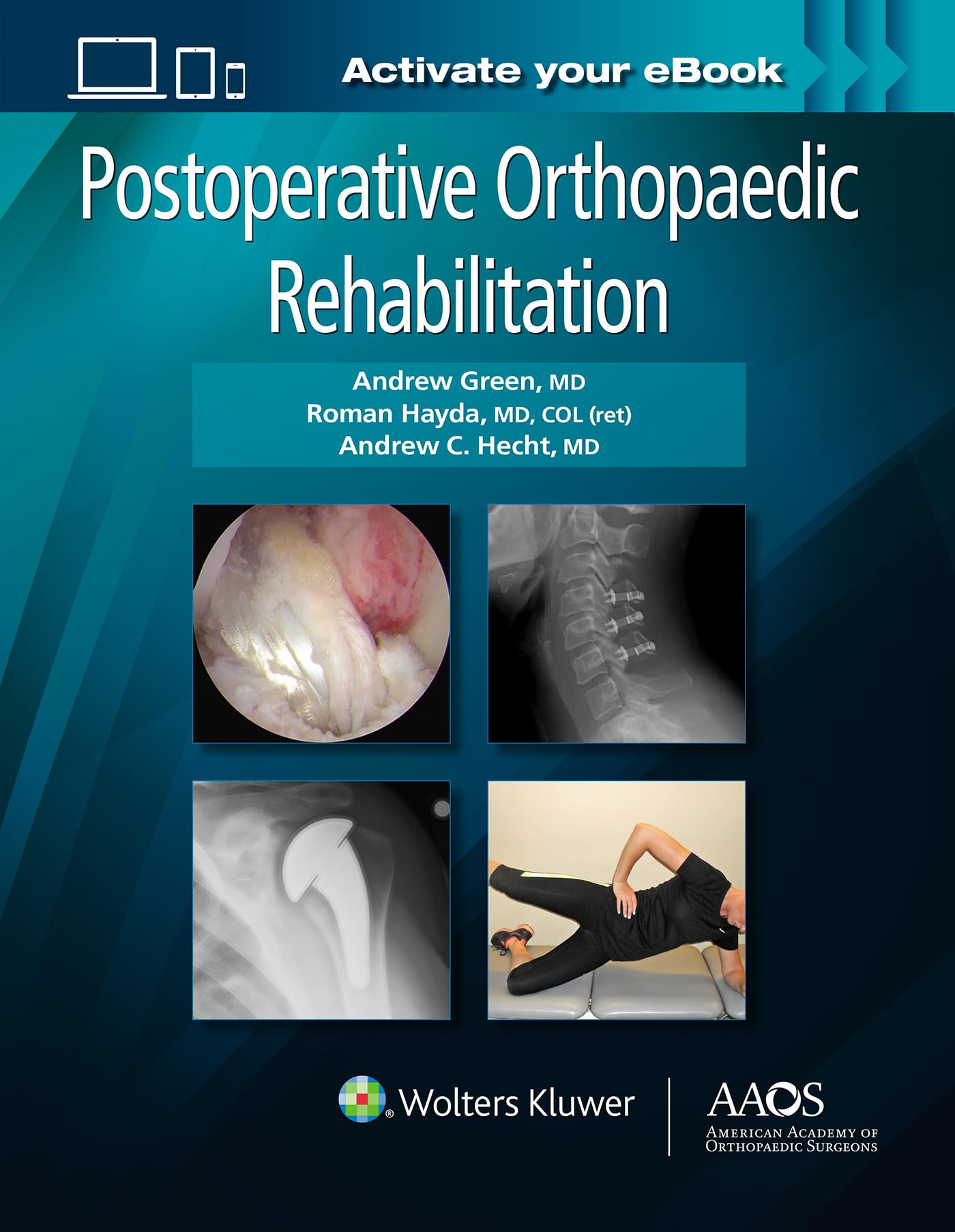 Postoperative Orthopaedic Rehabilitation: Print + Ebook (Aaos  American Academy Of Orthopaedic Surgeons)