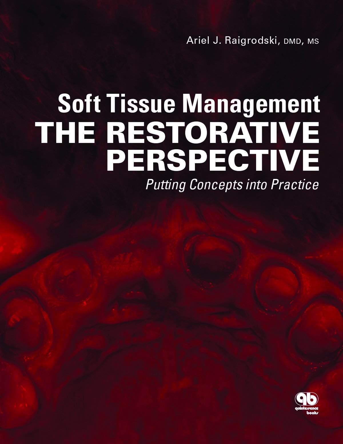 SOFT TISSUE MANAGEMENT THE RESTORATIVE PERSPECTIVE PUTTING CONCEPTS INTO PRACTICE (HB 2015)
