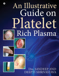 An Illustrative Guide On Platelet Rich Plasma