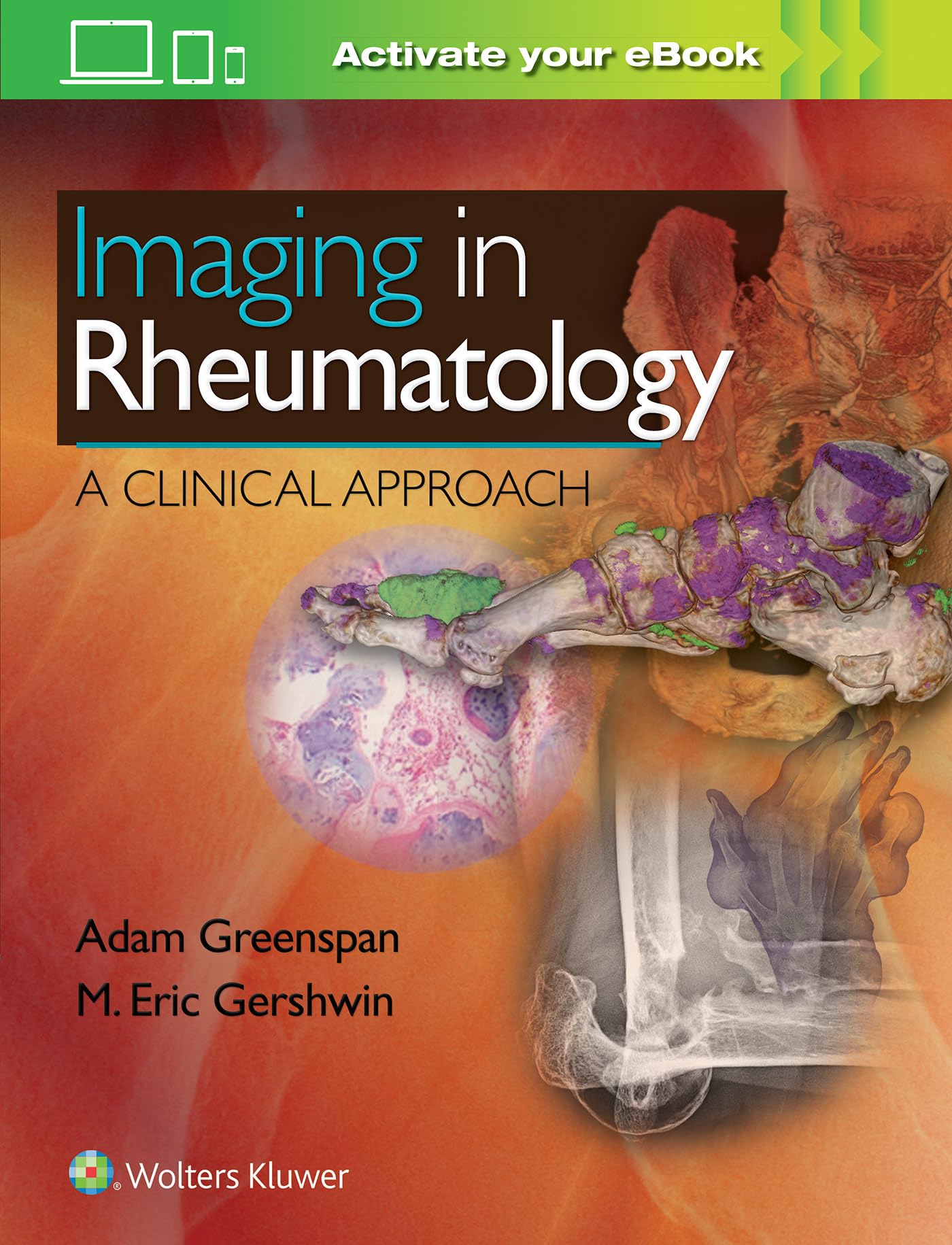 Imaging In Rheumatology A Clinical Approach (Hb 2018)