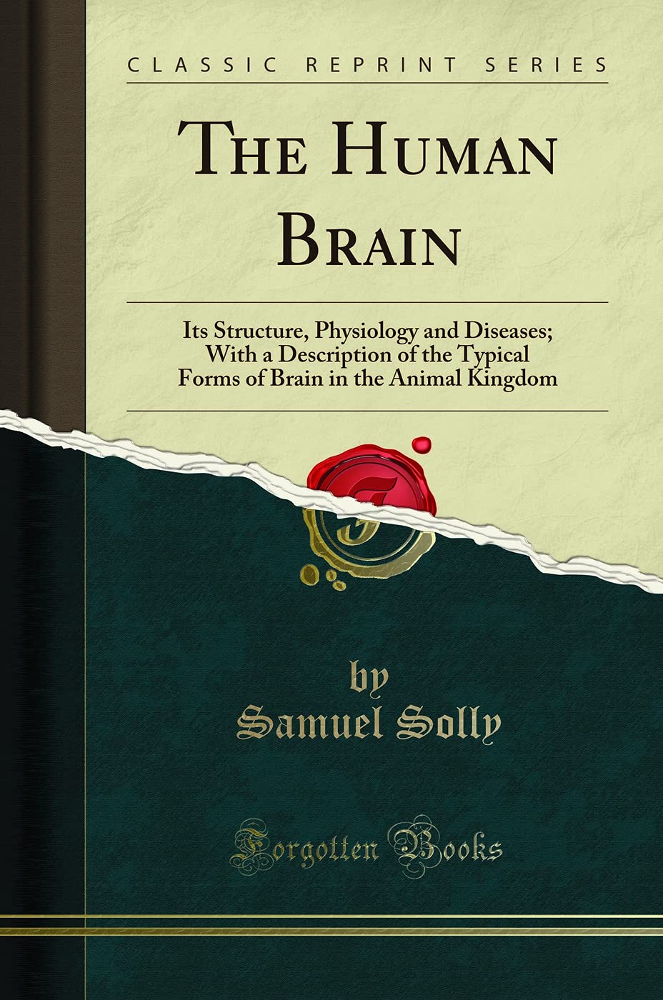 The Human Brain: Its Structure, Physiology and Diseases; With a Description of the Typical Forms of Brain in the Animal Kingdom 