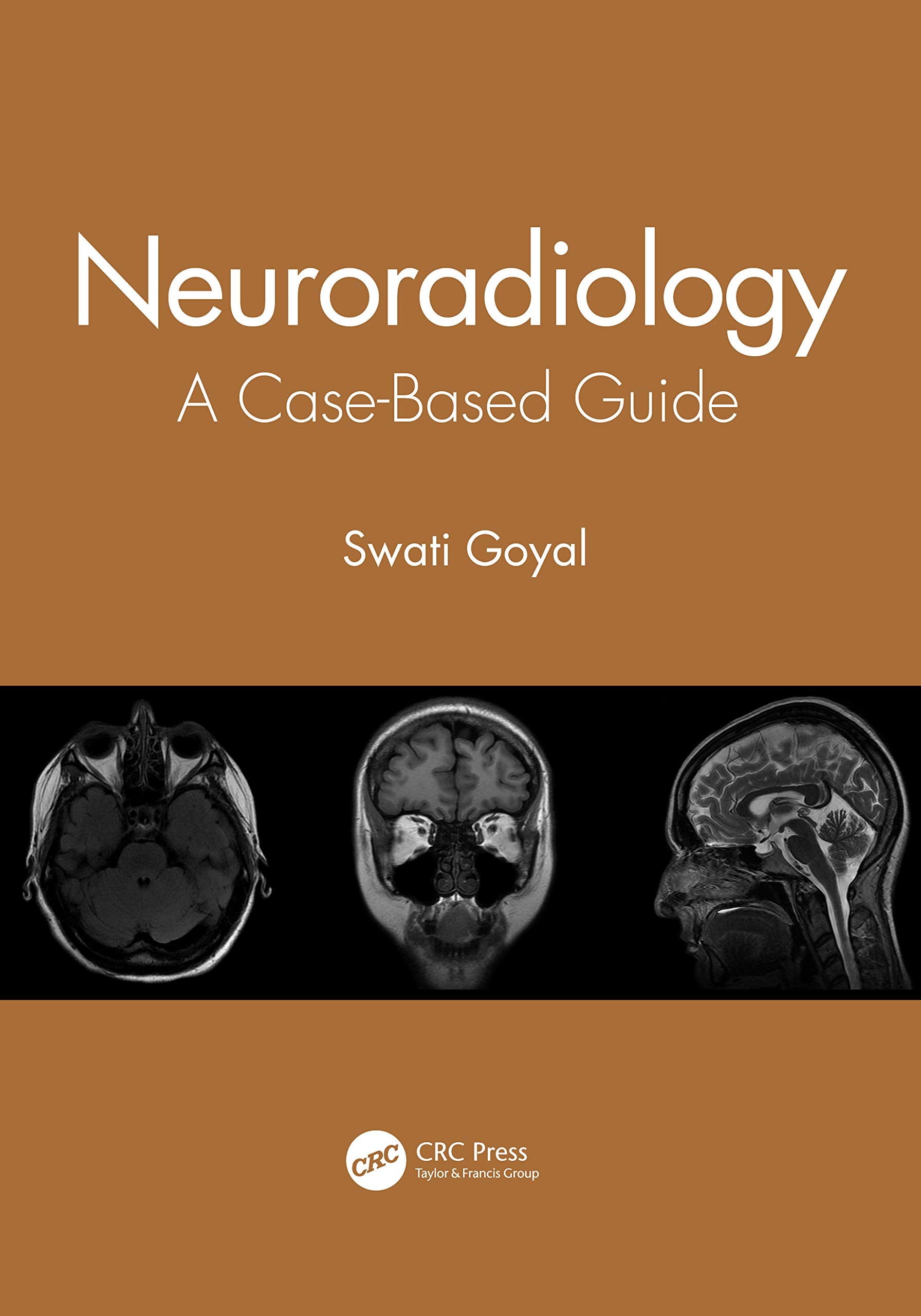 Neuroradiology A Case Based Guide (Pb 2021)