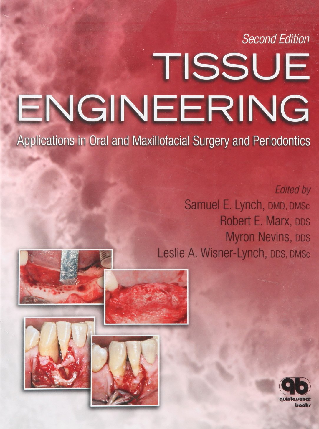 Tissue Engineering: Applications in Oral and Maxillofacial Surgery and Periodontics
