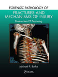 Forensic Pathology Of Fractures And Mechanisms Of Injury Postmortem Ct Scanning (Pb 2021)