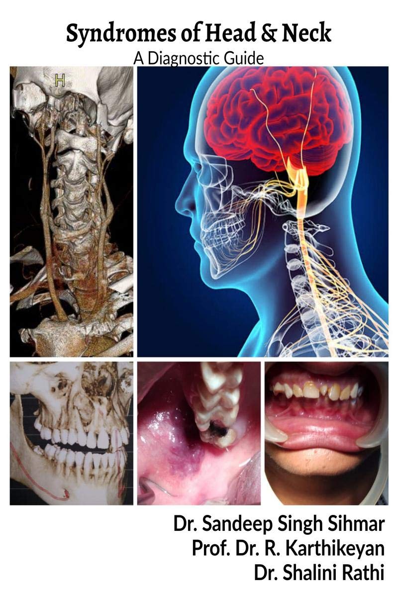 Syndromes Of Head And Neck: A Diagnostic Guide