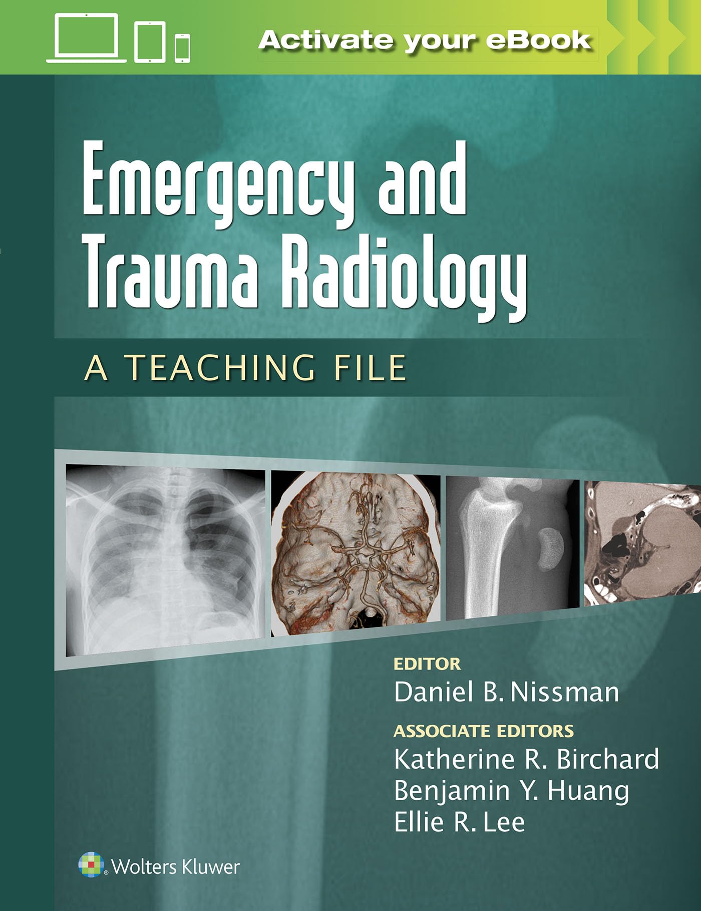 Emergency And Trauma Radiology A Teaching File (Pb 2016) (Lww Teaching File Series)