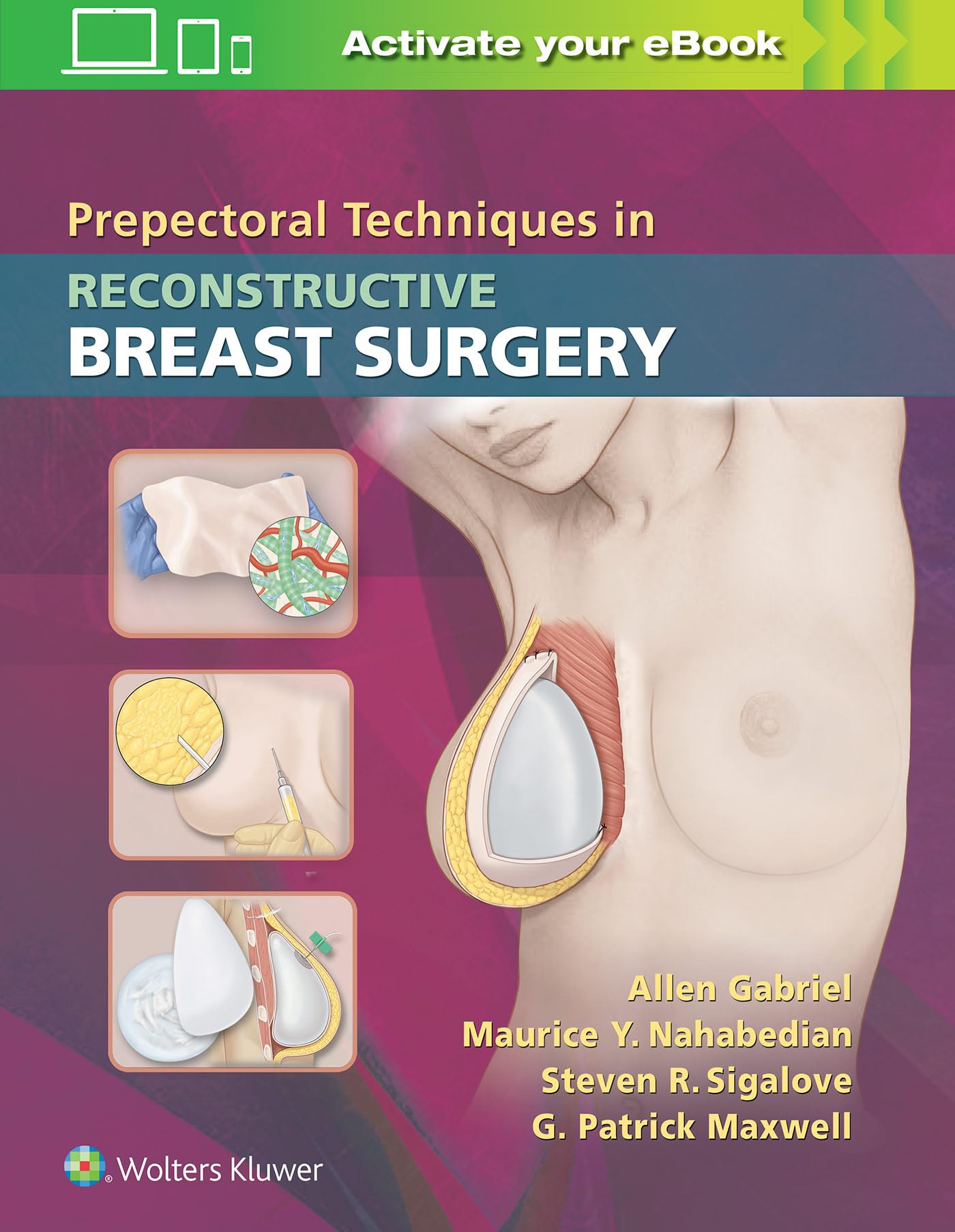 PREPECTORAL TECHNIQUES IN RECONSTRUCTIVE BREAST SURGERY (HB 2019)