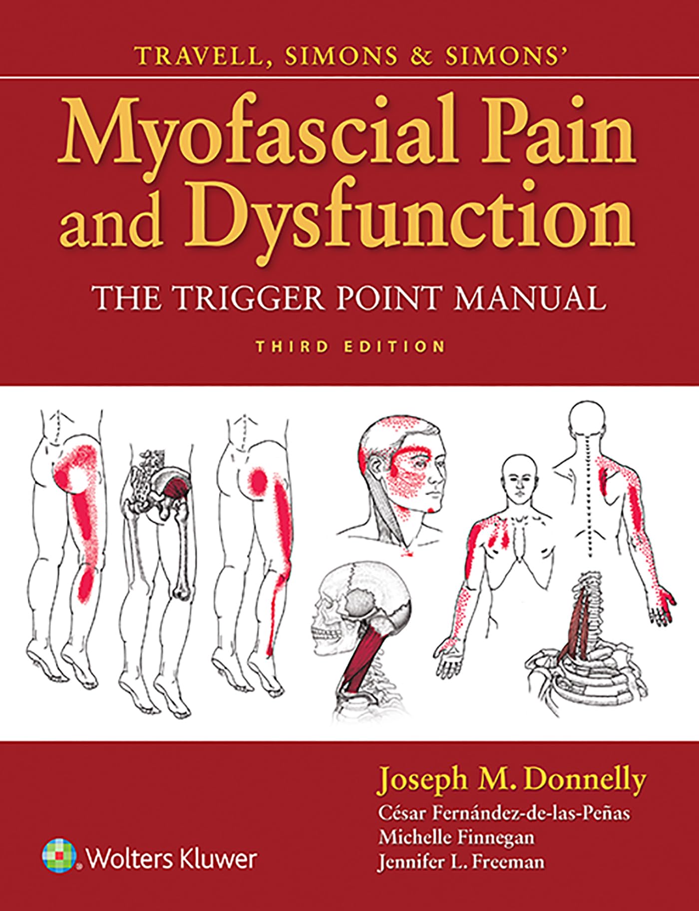 Travell, Simons & Simons Myofascial Pain and Dysfunction: The Trigger Point Manual