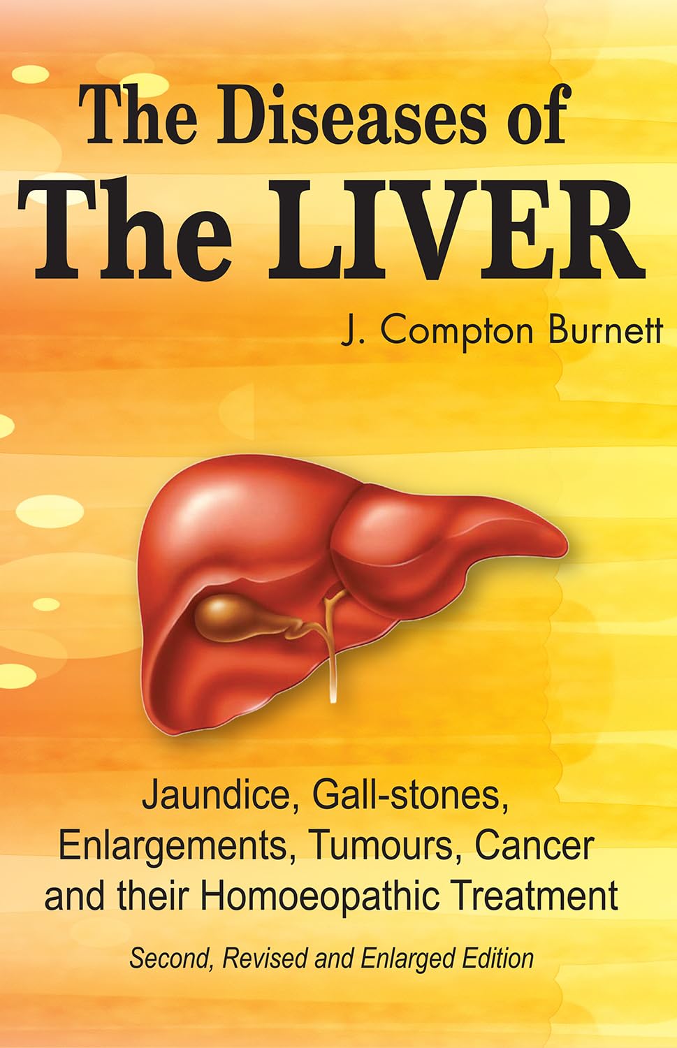 The Diseases of the Liver  Jaundice, GallStones, Enlargements, Tumours, Cancer and their Homeopathic Treatment (Second Revised