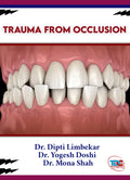 TRAUMA FROM OCCLUSION