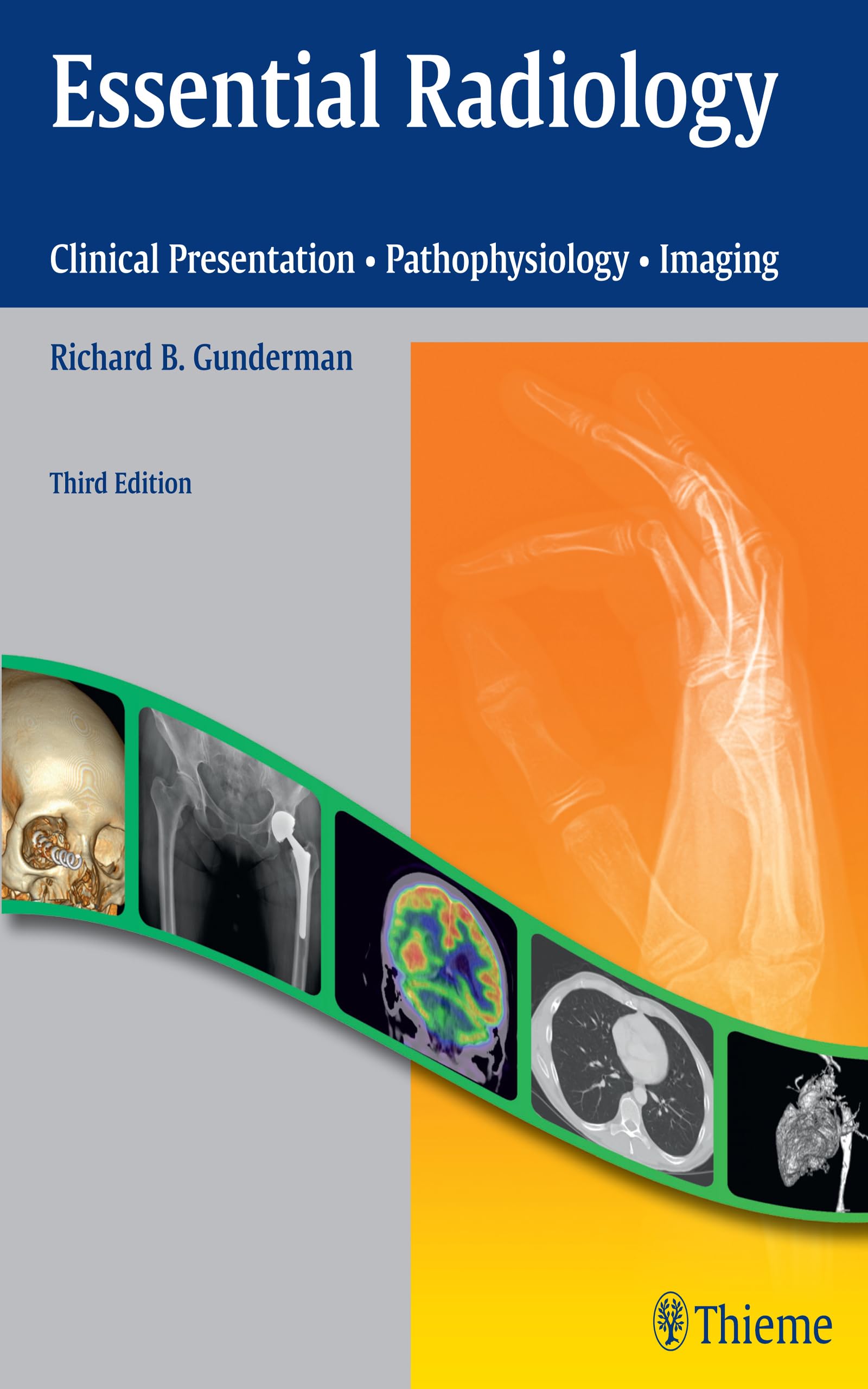 Essential Radiology: Clinical Presentation, Pathophysiology, Imaging