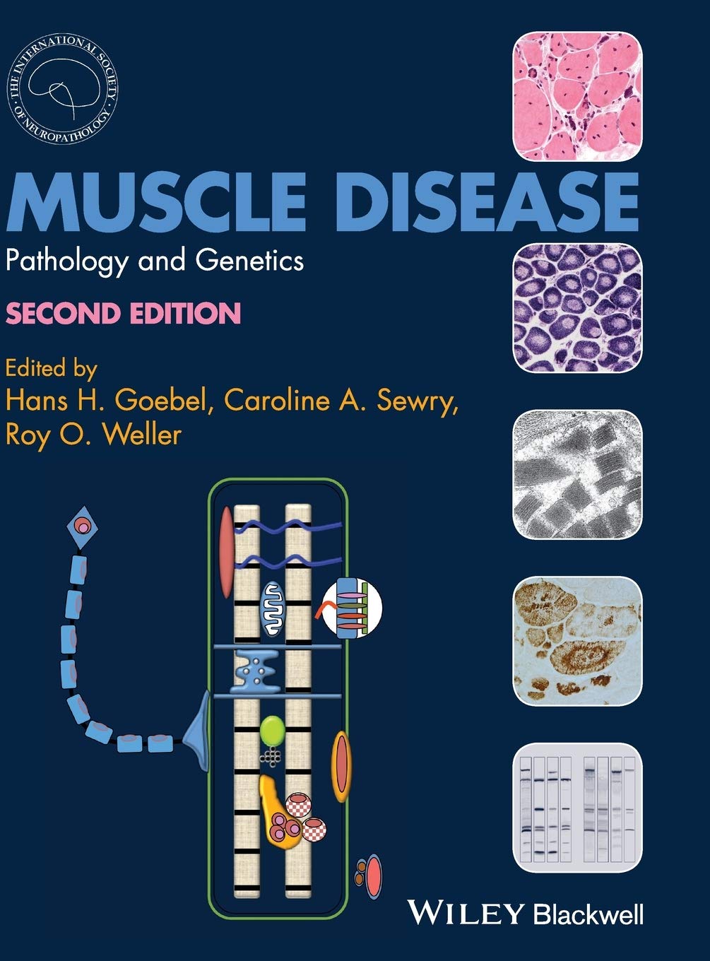 Muscle Disease: Pathology and Genetics