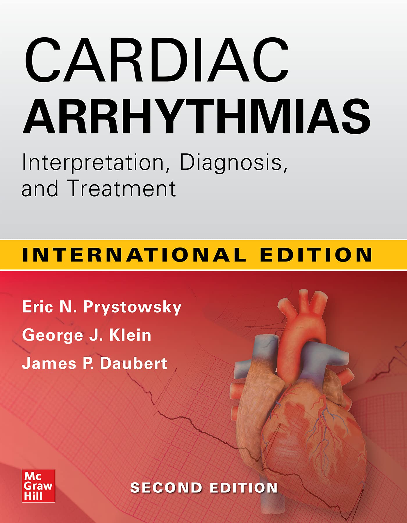 Cardiac Arrhythmias: Interpretation, Diagnosis and Treatment, 2nd Edition