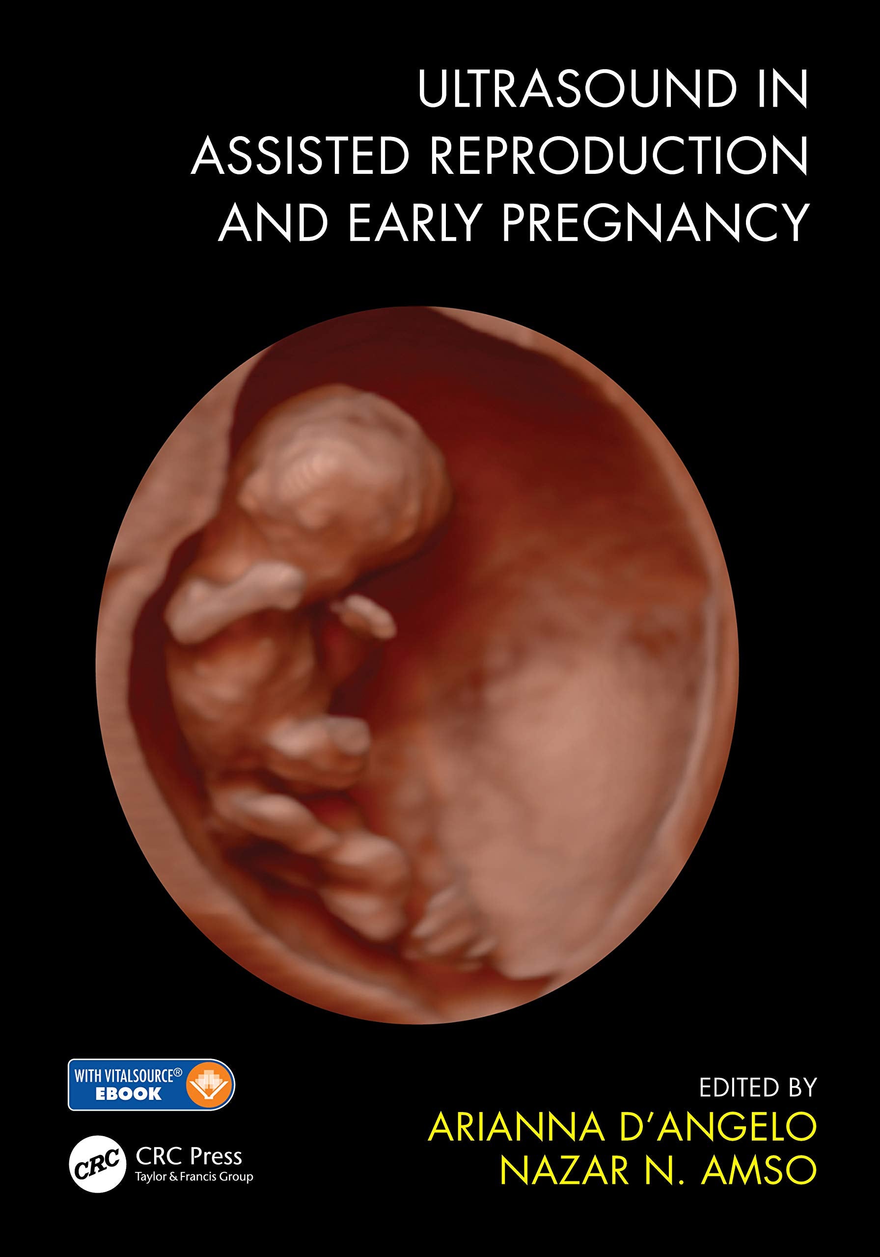 Ultrasound In Assisted Reproduction And Early Pregnancy With Access Code (Pb 2021)