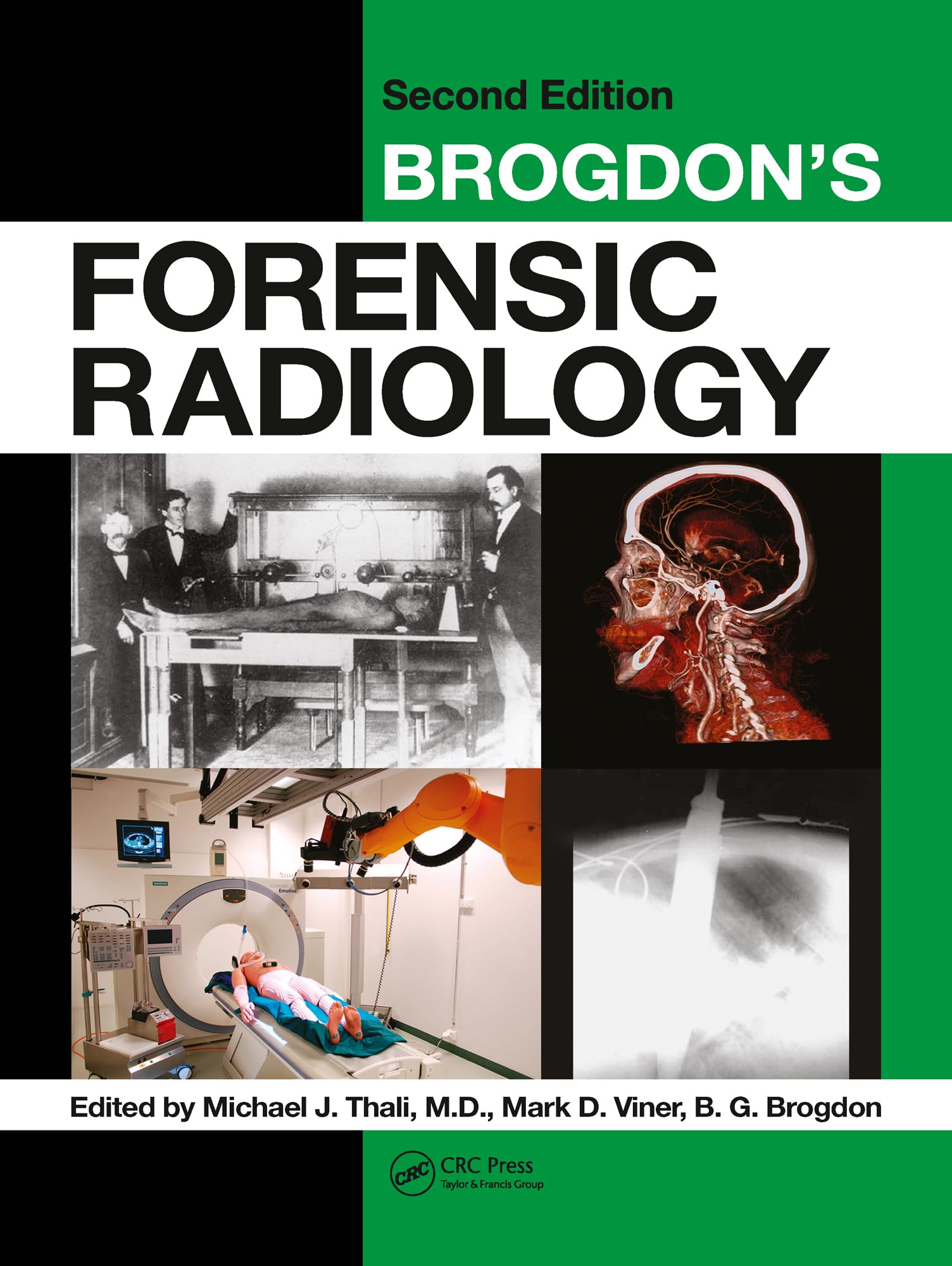 Brogdons Forensic Radiology