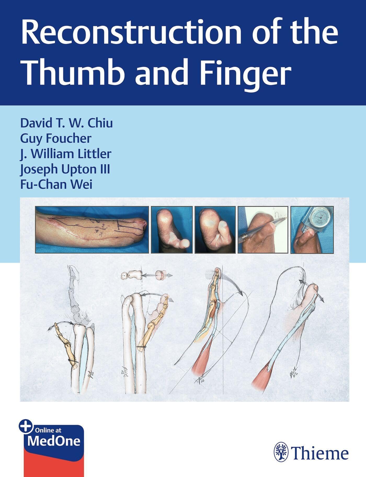 RECONSTRUCTION OF THE THUMB AND FINGER WITH ACCESS CODE (HB 2025)