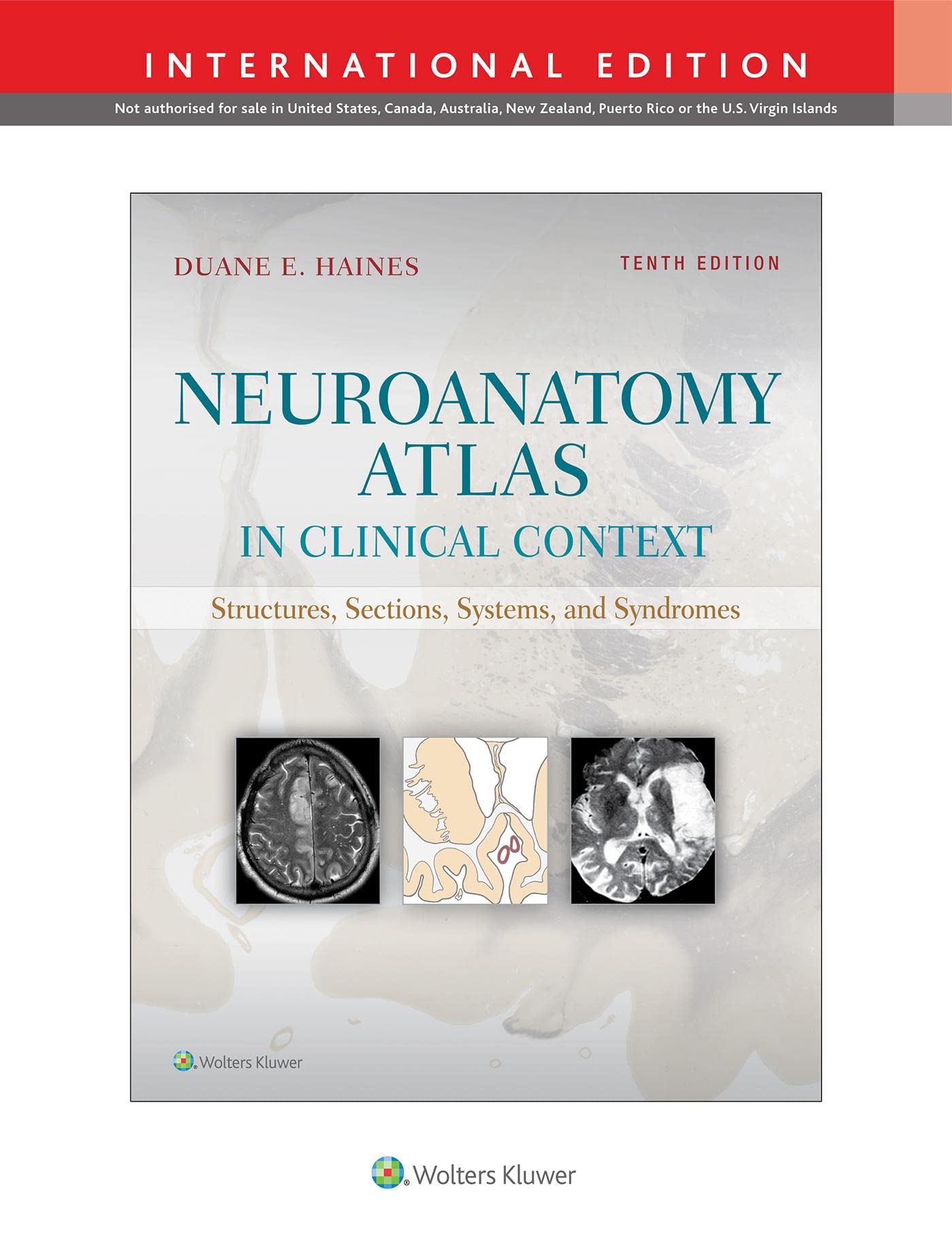 NEUROANATOMY ATLAS IN CLINICAL CONTEXT STRUCTURES SECTIONS SYSTEMS AND SYNDROMES WITH ACCESS CODE 10ED