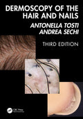 DERMOSCOPY OF THE HAIR AND NAILS 3ED (HB 2025)