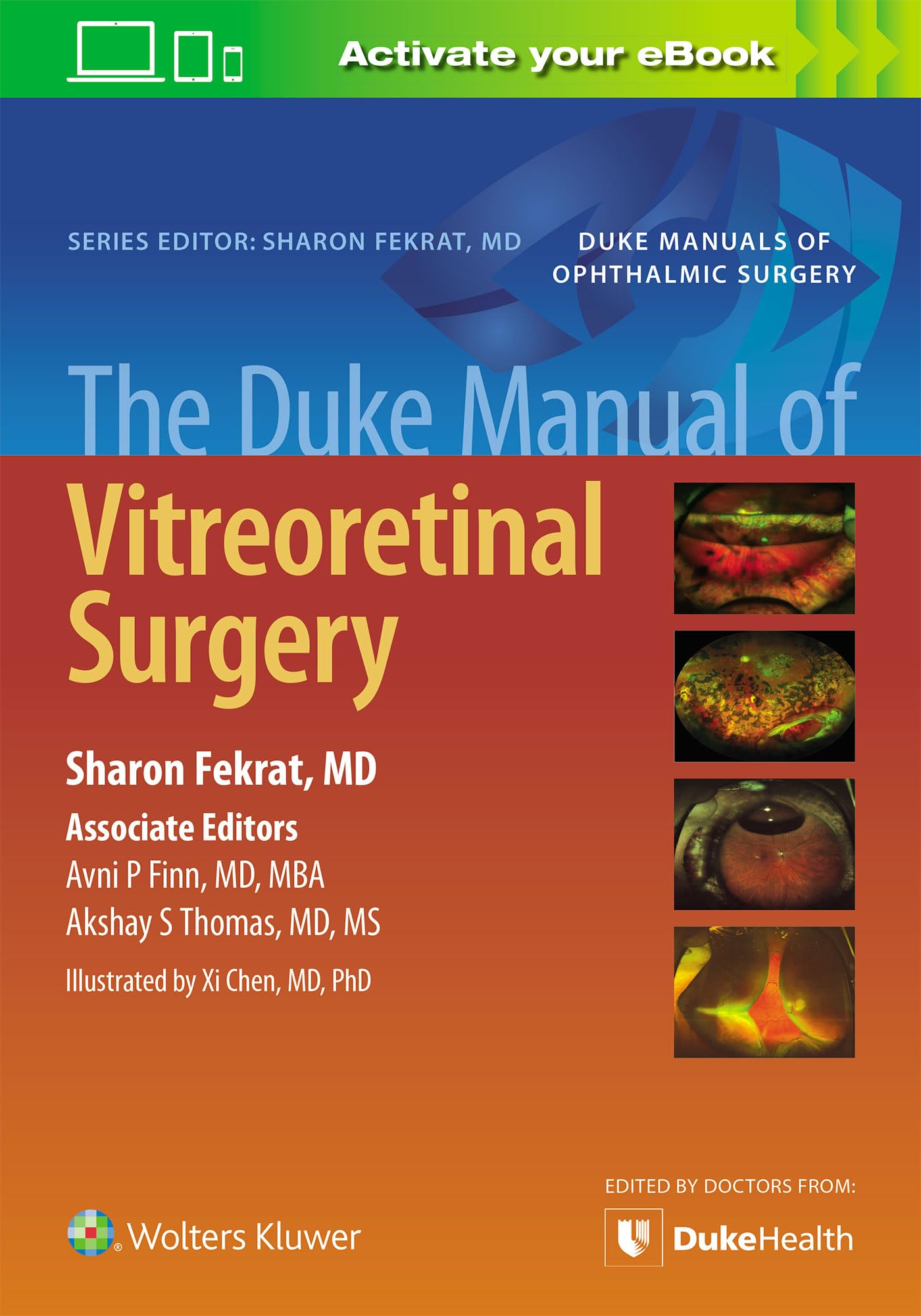 The Duke Manual Of Vitreoretinal Surgery (Pb 2021)