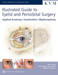 ILLUSTRATED GUIDE TO EYELID AND PERIORBITAL SURGERY APPLIED ANATOMY EXAMINATION BLEPHAROPLASTY (HB 2015) (Aesthetic Methods for 