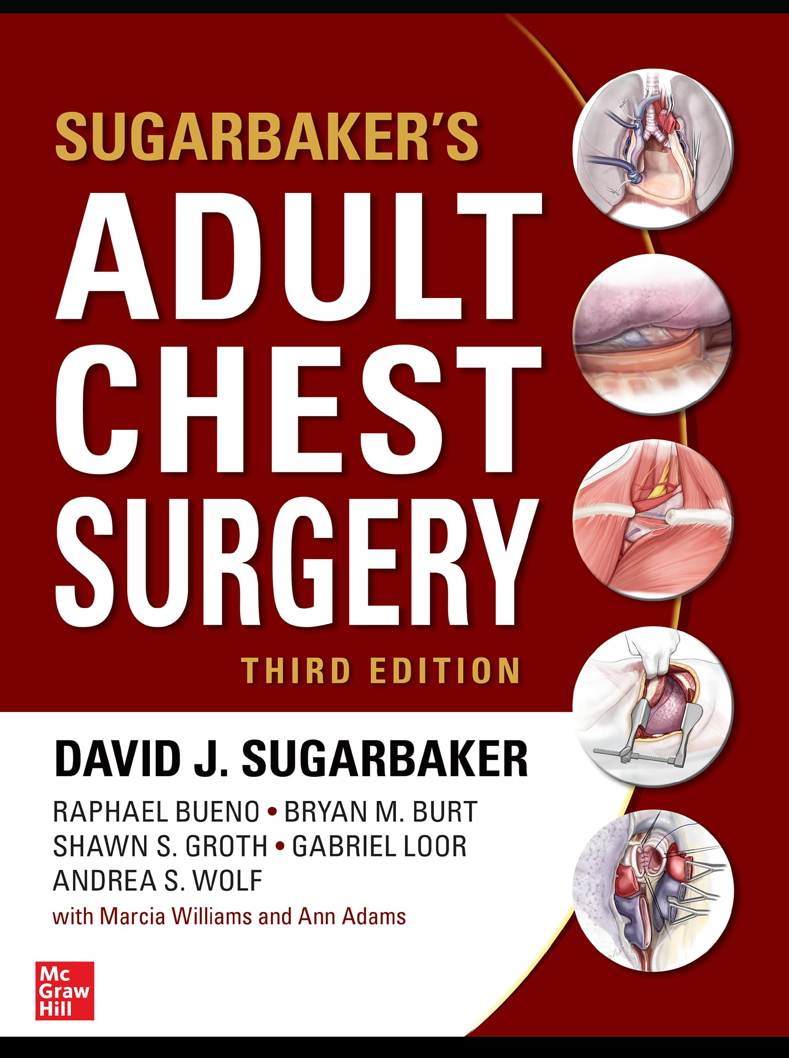 Adult Chest Surgery 3Ed (MEDICAL/DENISTRY)