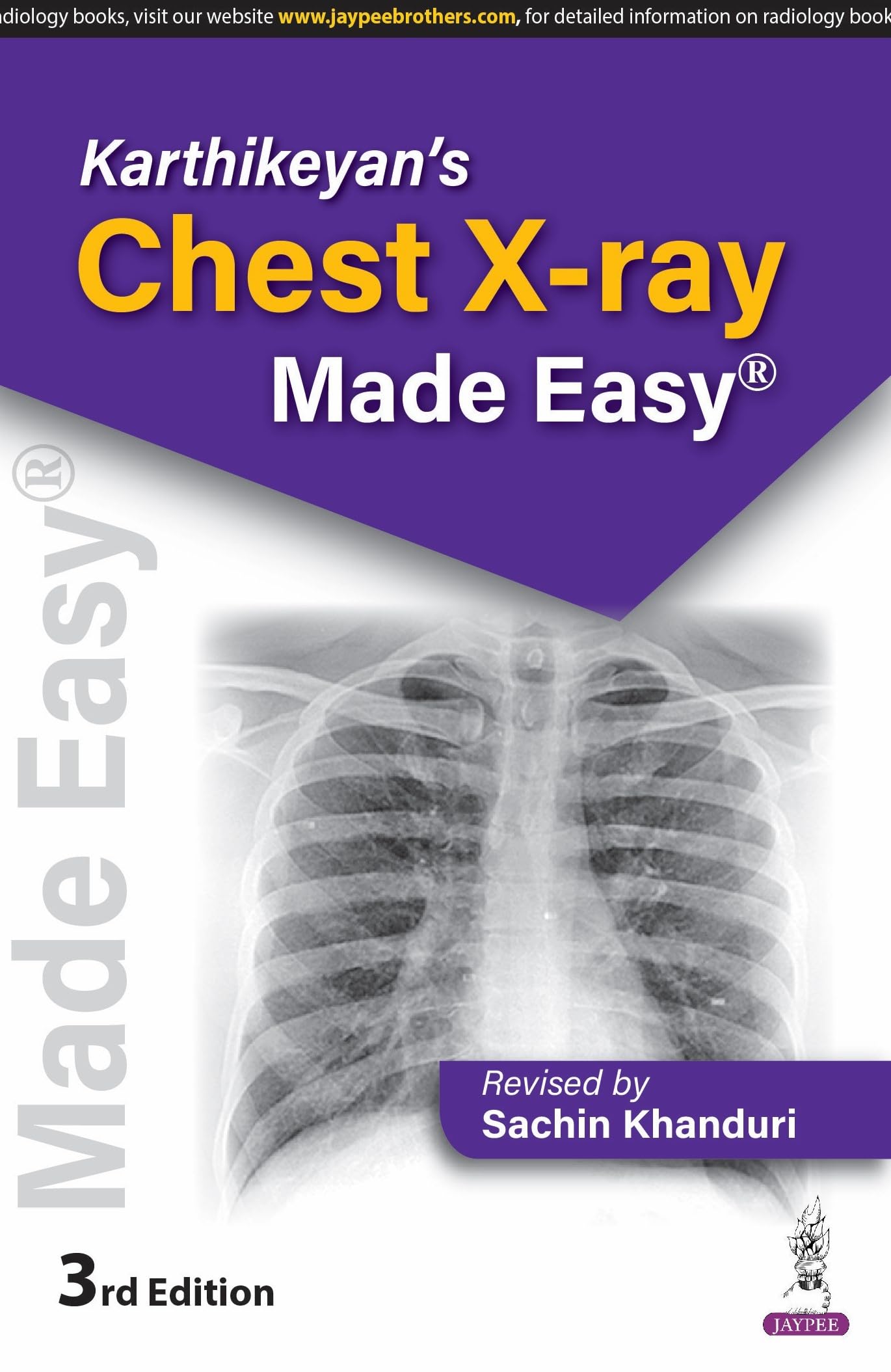 KARTHIKEYANS CHEST XRAY MADE EASY