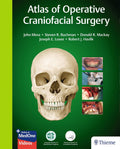 ATLAS OF OPERATIVE CRANIOFACIAL SURGERY WITH ACCESS CODE (HB 2019)