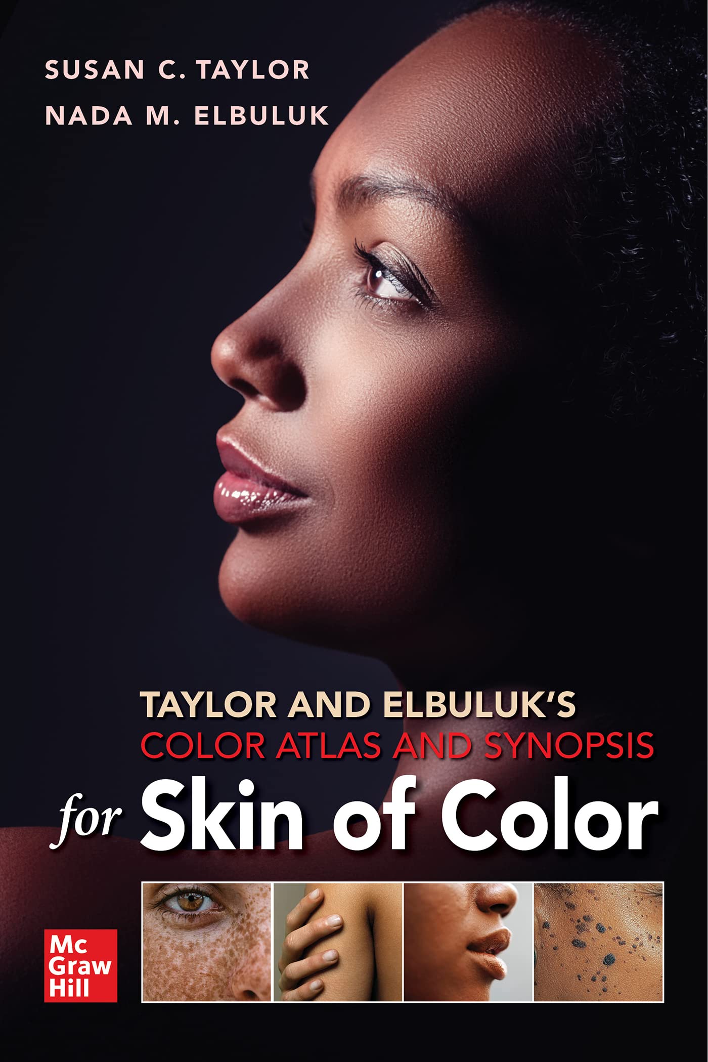 TAYLOR AND ELBULUKS COLOR ATLAS AND SYNOPSIS FOR SKIN OF COLOR (PB 2023)
