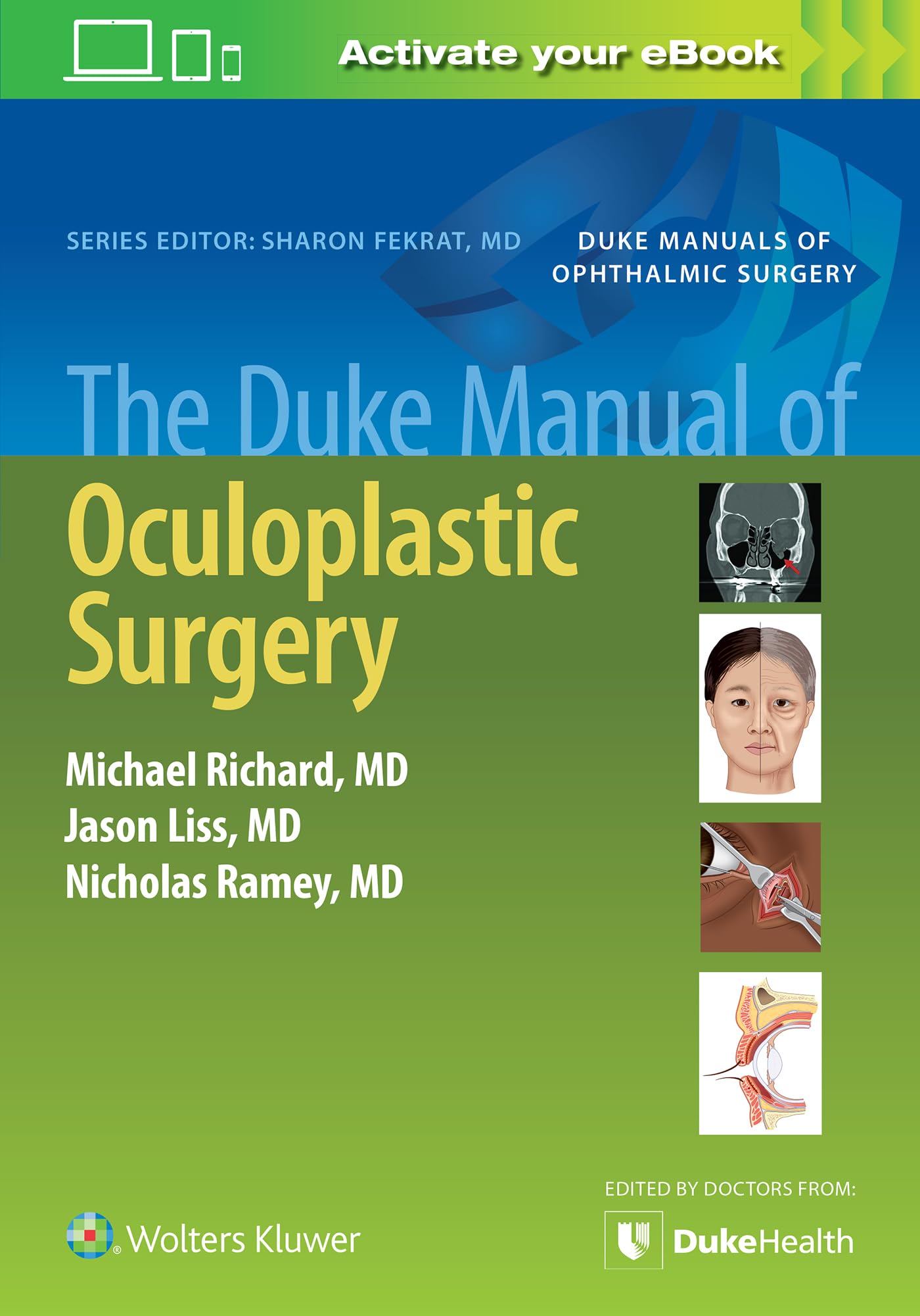 The Duke Manual Of Oculoplastic Surgery