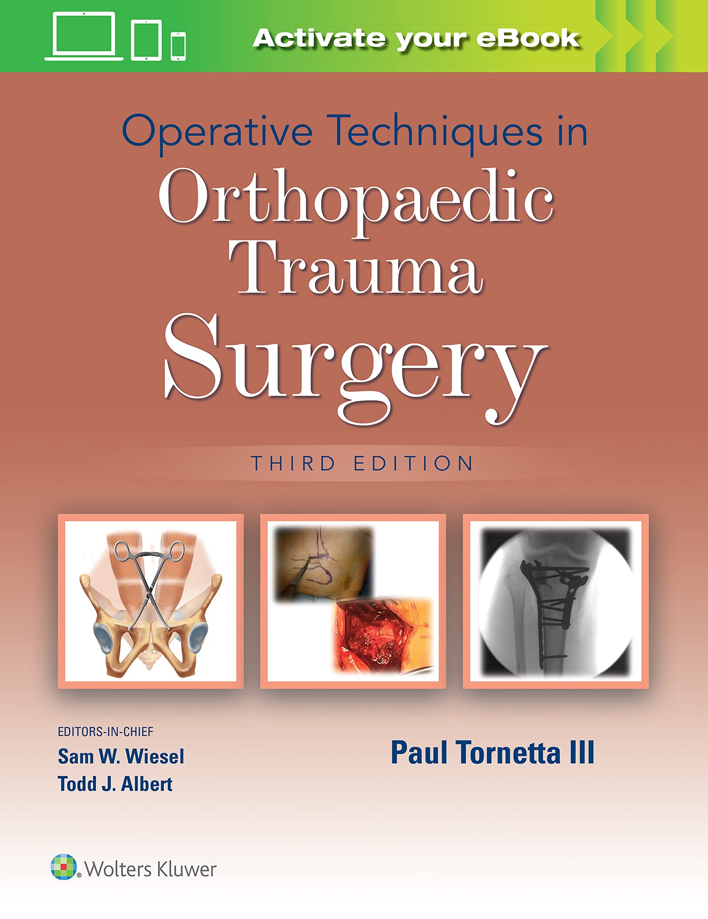 Operative Techniques In Orthopaedic Trauma Surgery 3Ed (Hb 2022)