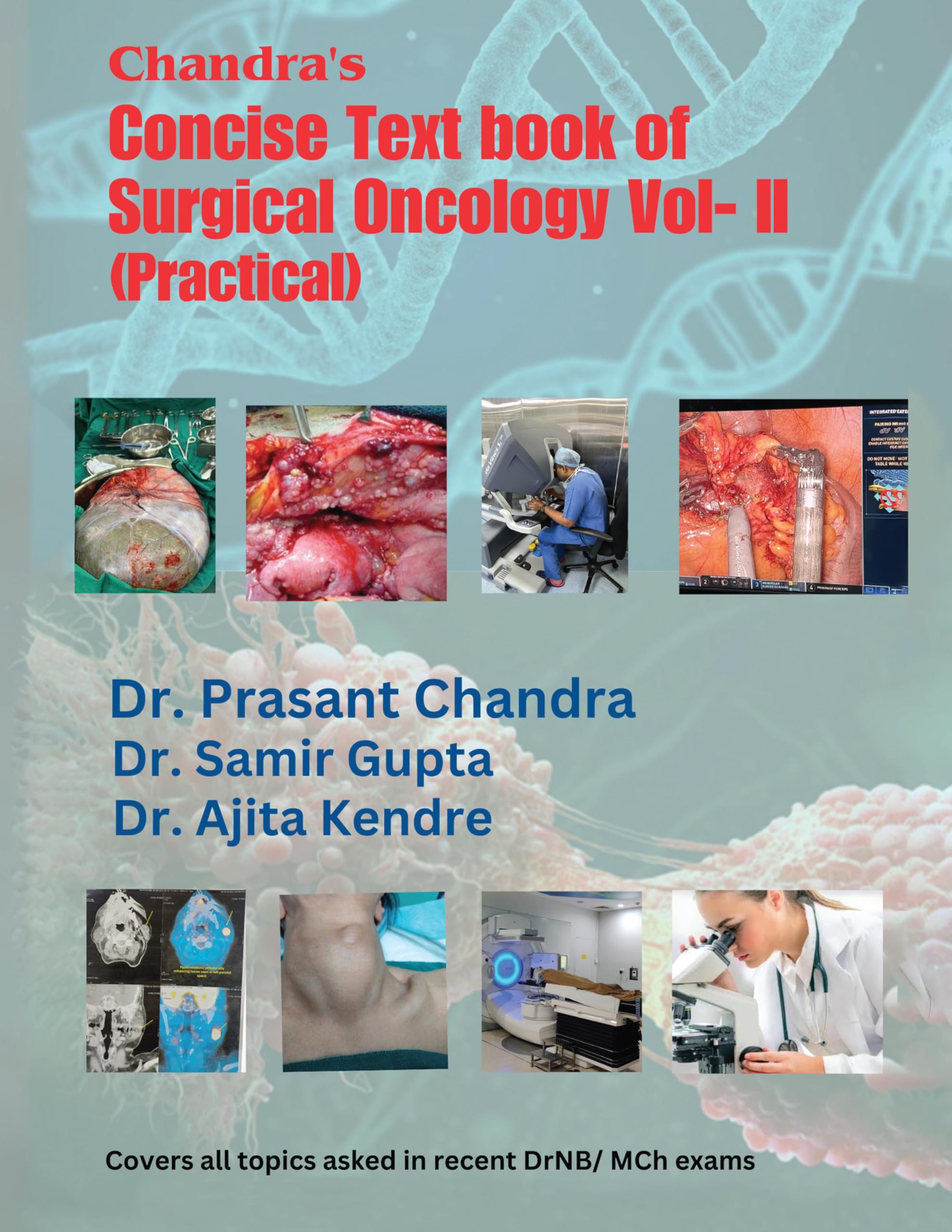Chandras Concise Text book of Surgical Oncology Vol II(Practical) : 1st Edition