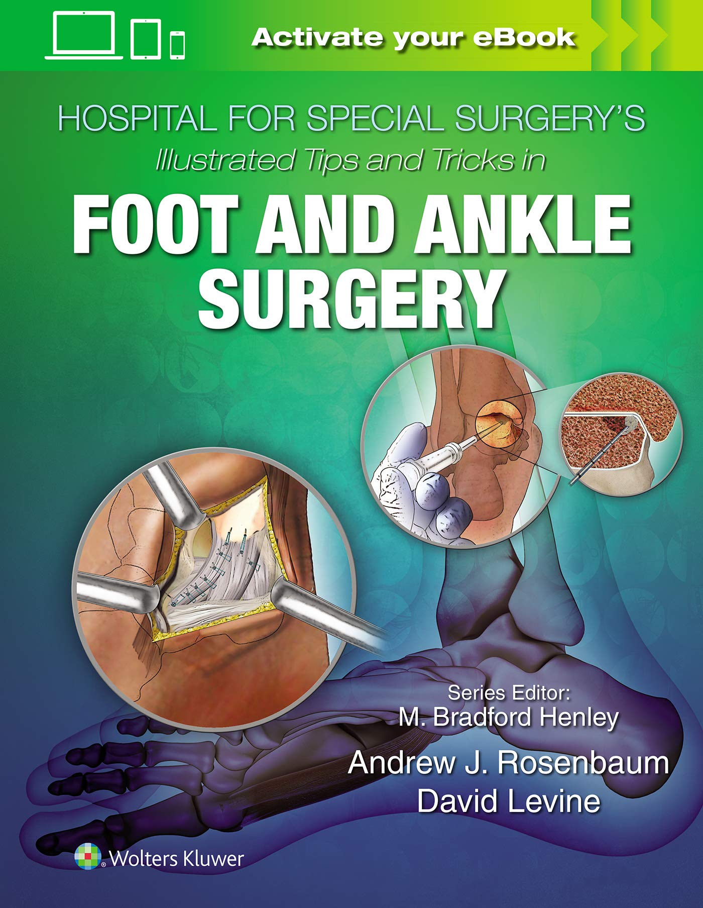 Hospital For Special Surgerys Illustrated Tips And Tricks In Foot And Ankle Surgery With Access Code (Hb 2020)