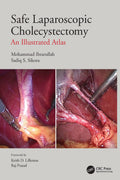 Safe Laparoscopic Cholecystectomy An Illustrated Atlas (Pb 2022)